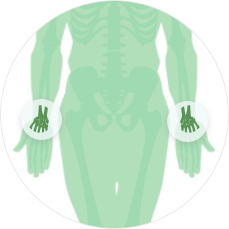 МРТ суставов - Лучезапястный сустав с одной стороны